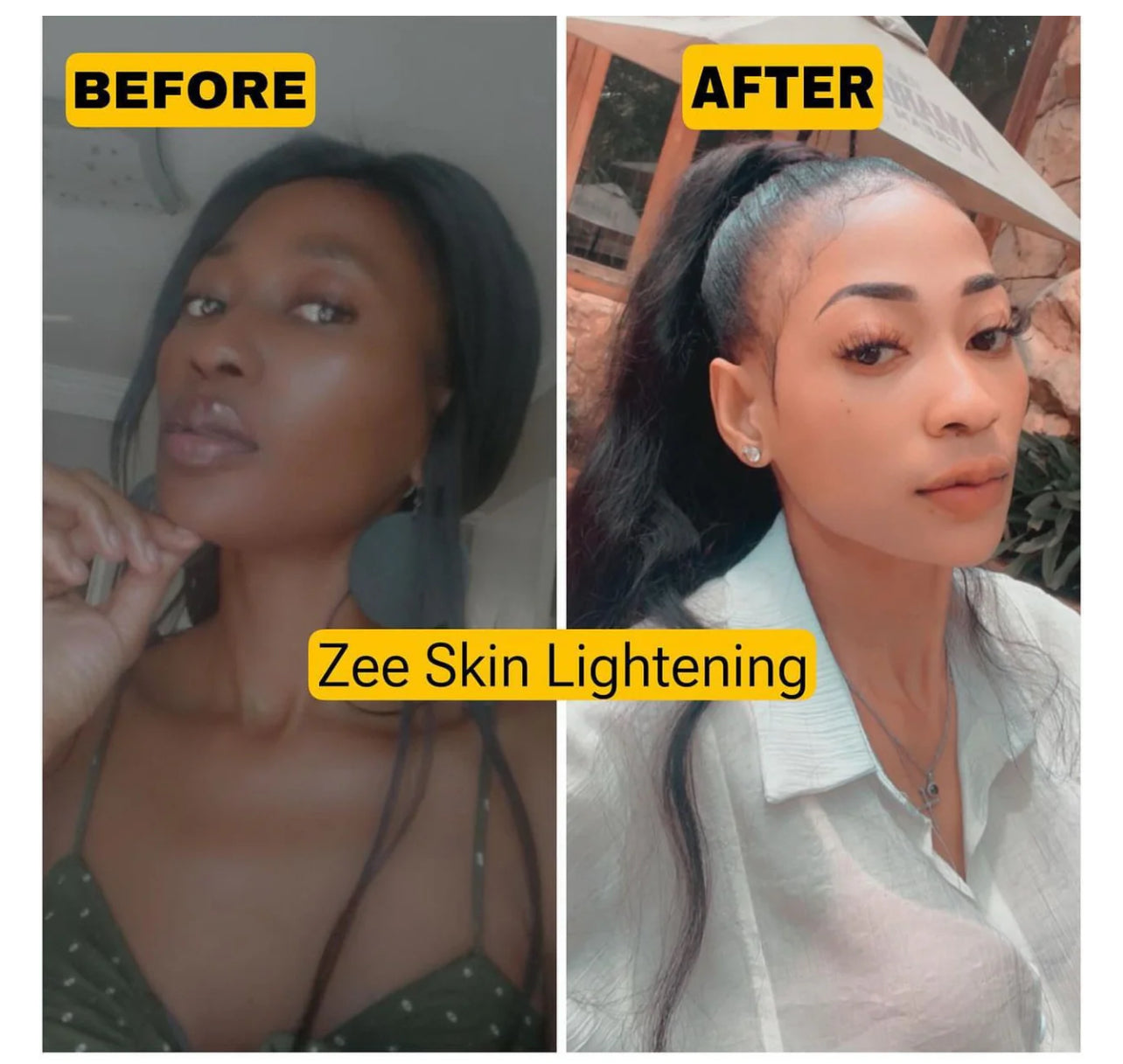 Extreme whitening kit+knuckle kit